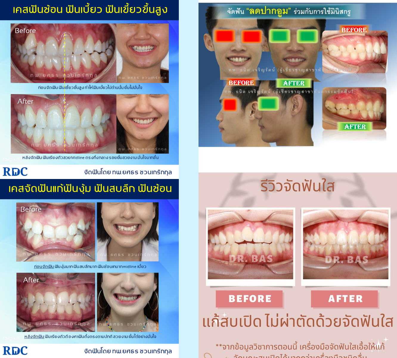 ตัวอย่างเคสการรักษา