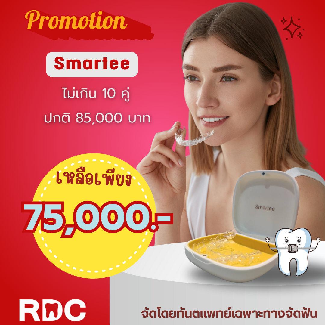 โปรโมชัน Smartee ไม่เกิน 10 คู่