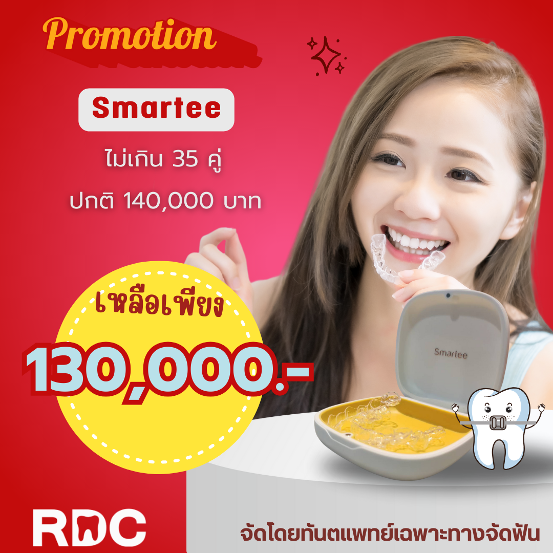 โปรโมชัน Smartee ไม่เกิน 35 คู่