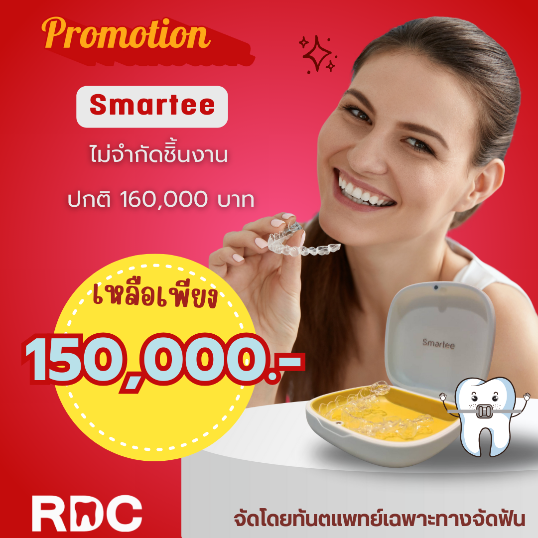 โปรโมชัน Smartee Full