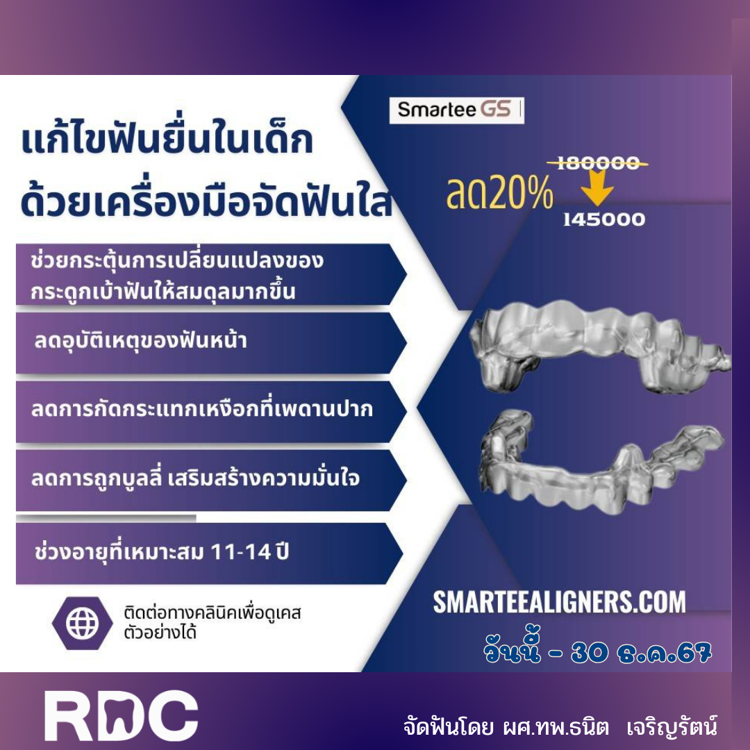 โปรโมชัน Smartee GS